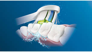 Philips sonicare bělení zubů